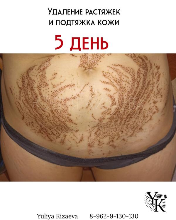 post image 5