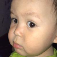 Albina