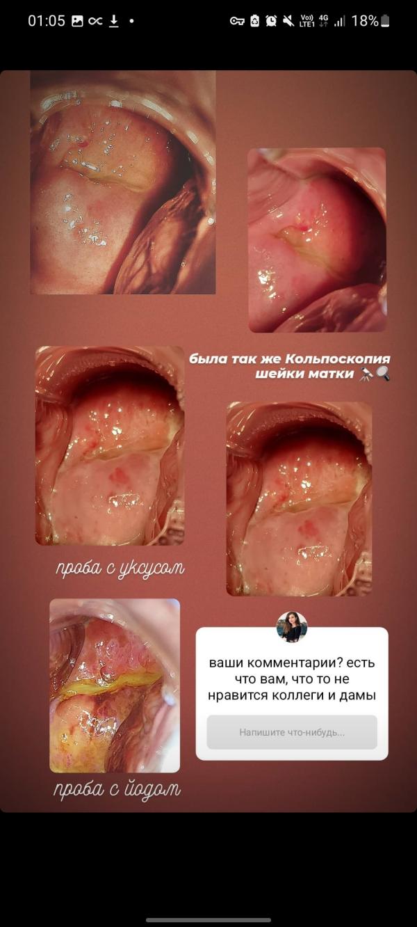 post image 5