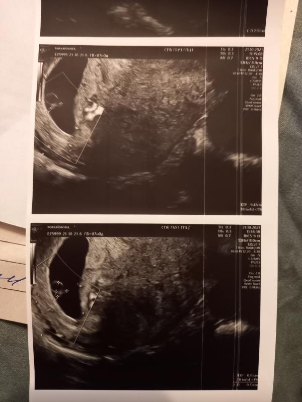 post image 4