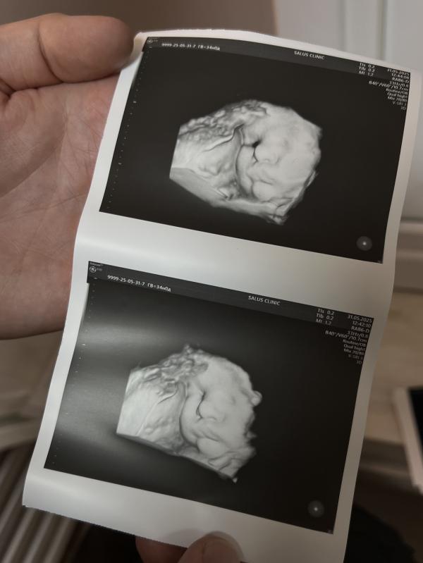 post image 4