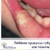 стикер