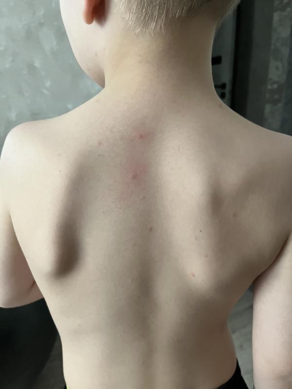 post image 2