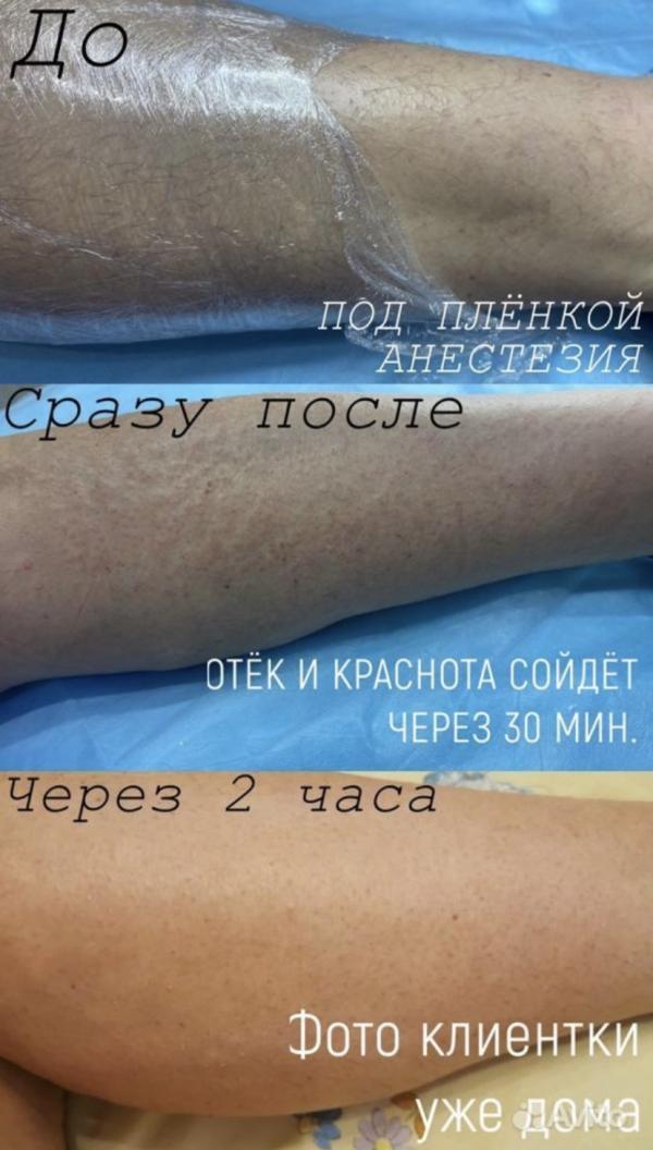 post image 5