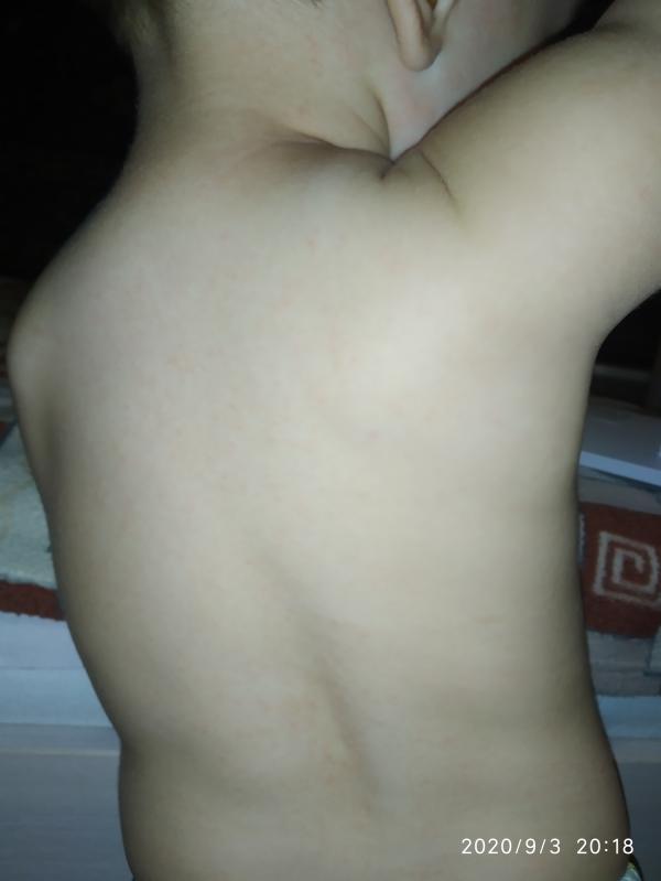 post image 3