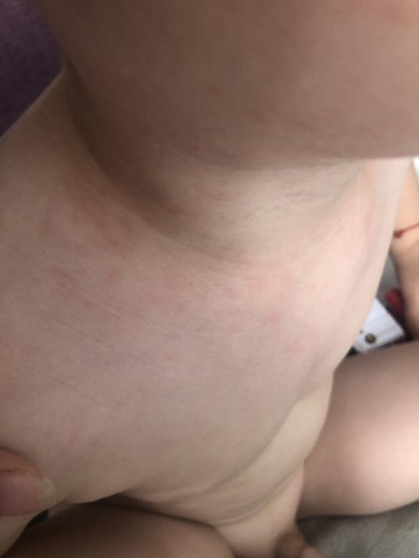 post image 4