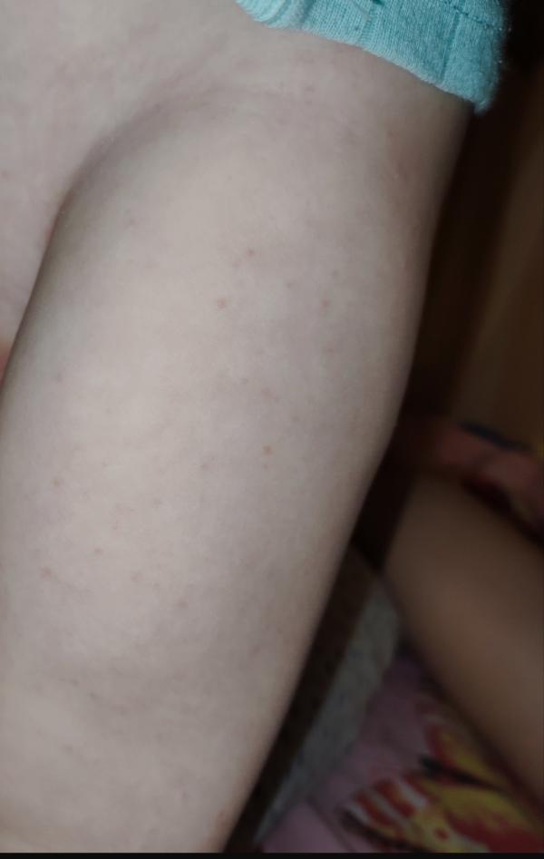 post image 4