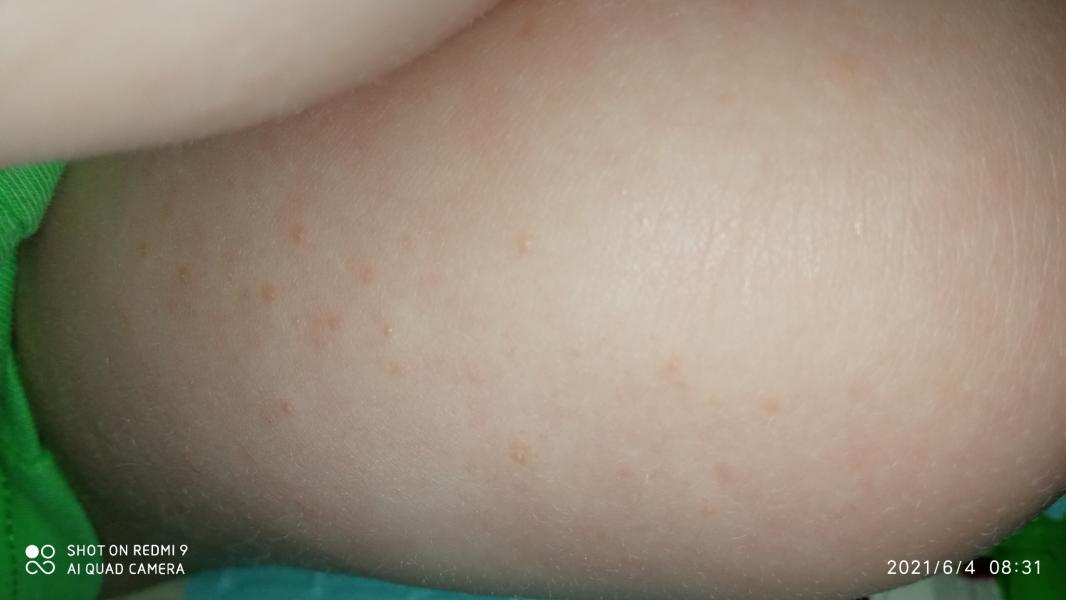 post image 3