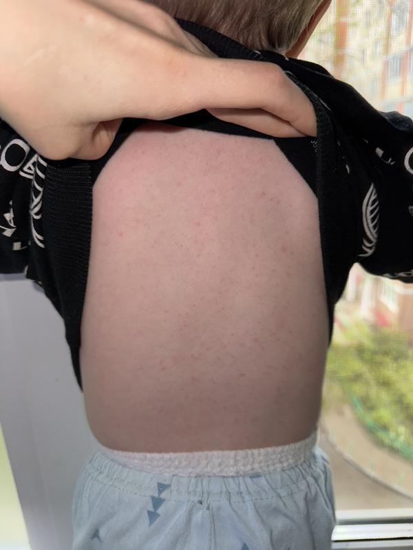 post image