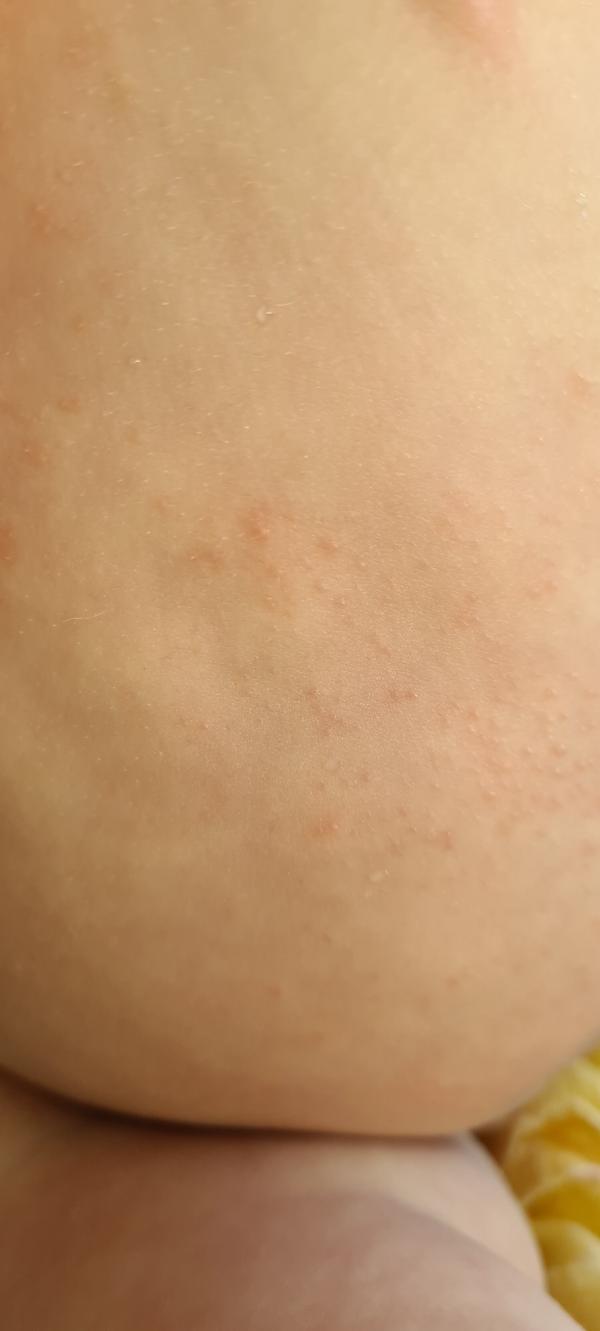 post image 4