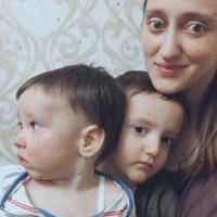 Альбина