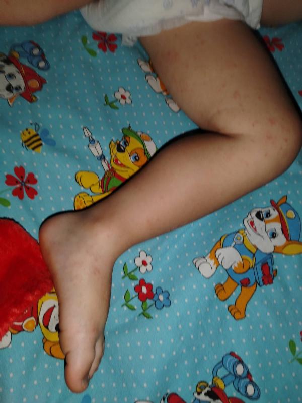 post image 4