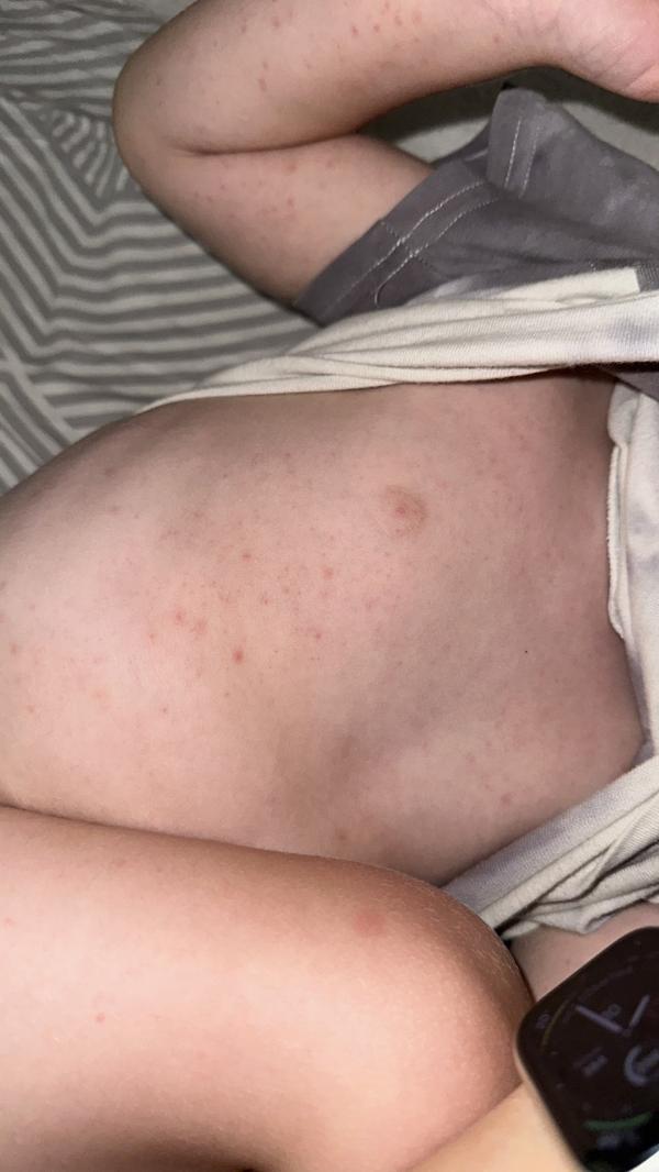 post image 2