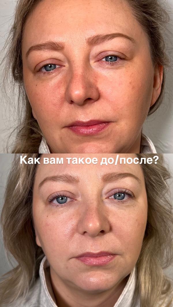post image 4