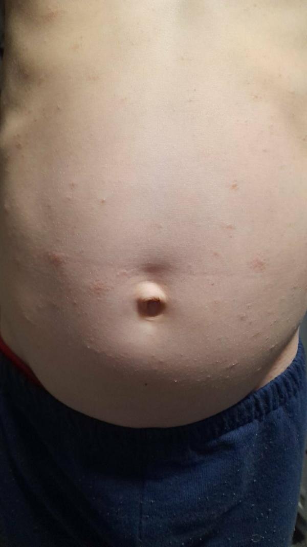 post image 1
