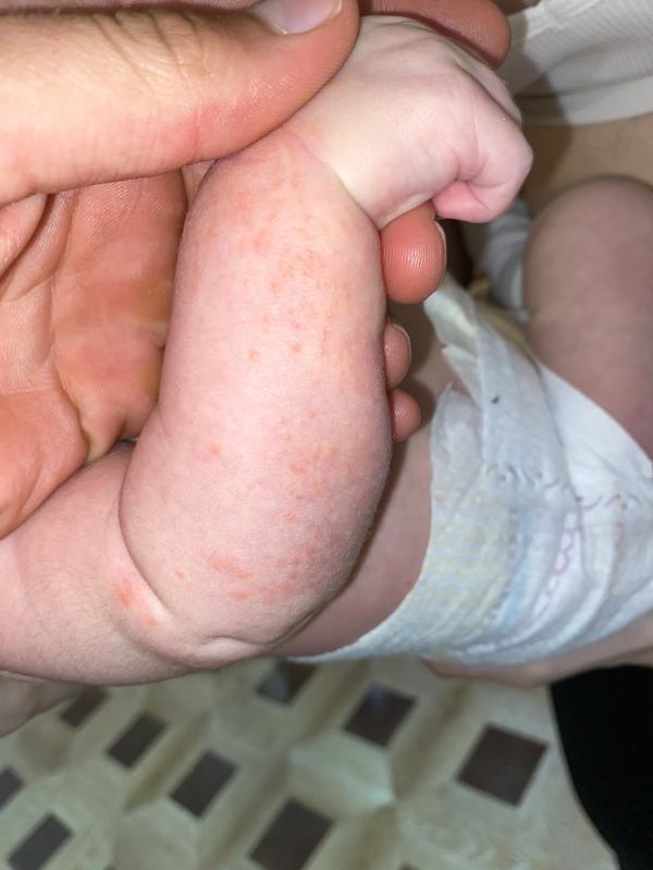 post image 3