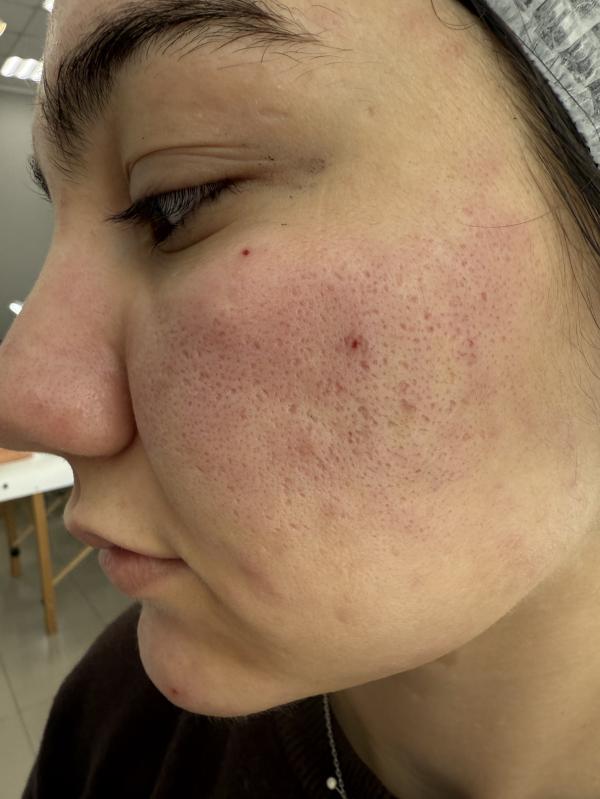 post image 4