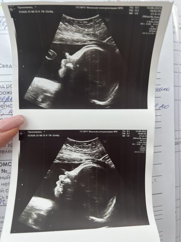 post image 4