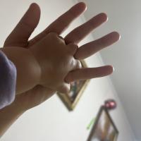 Erke