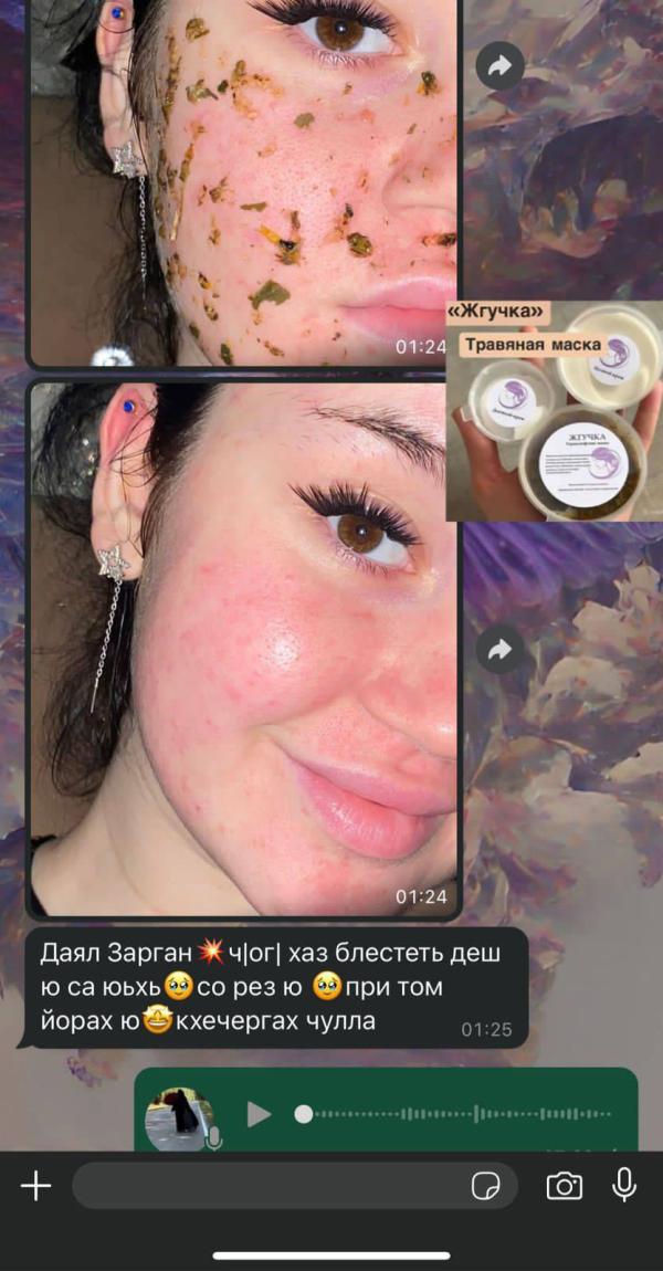 post image 4