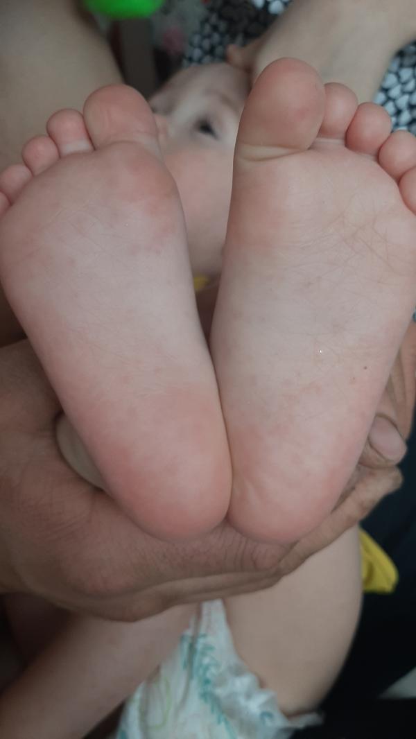 post image 4