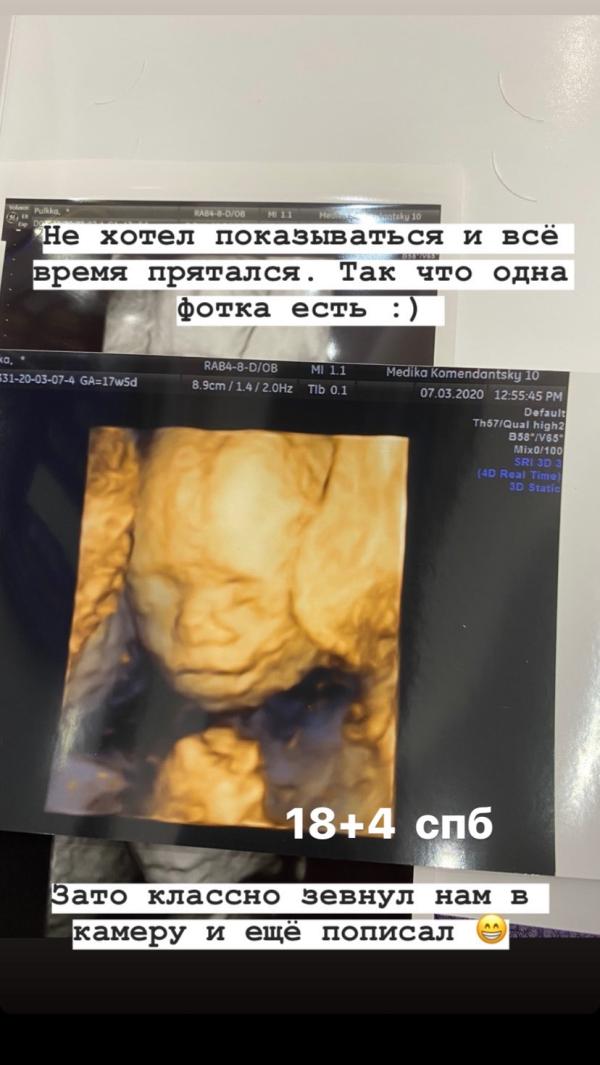 post image 5