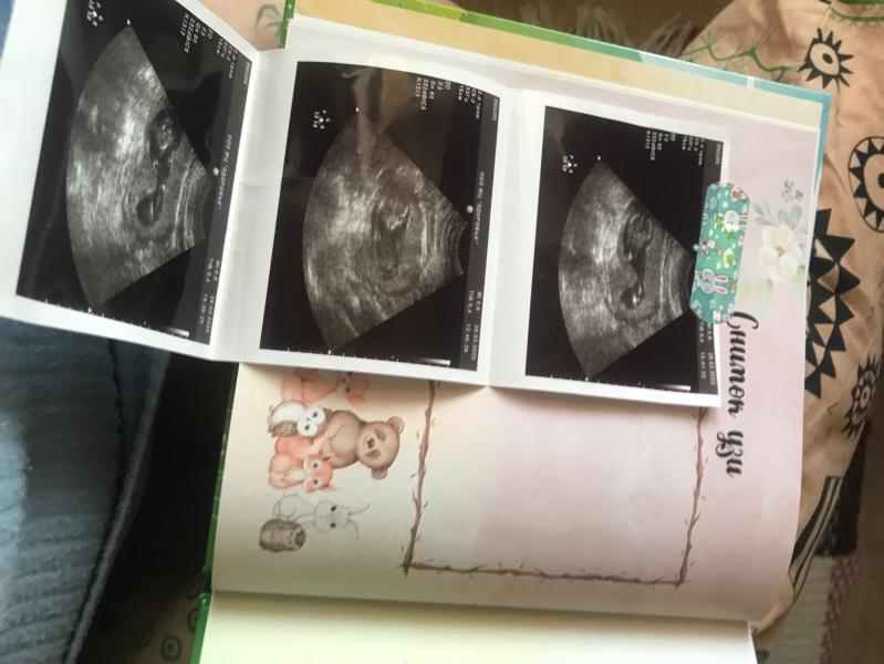 post image 4