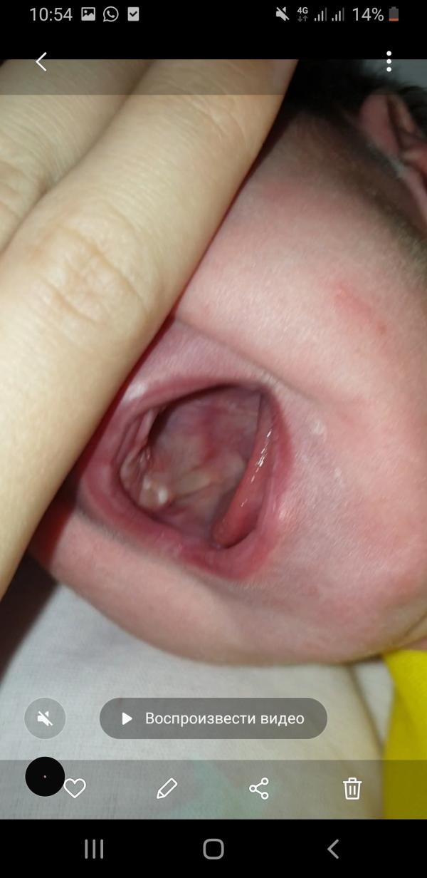 post image 2