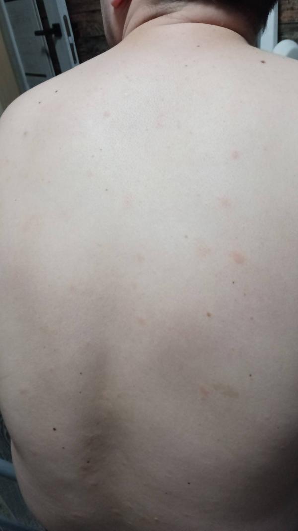 post image 2