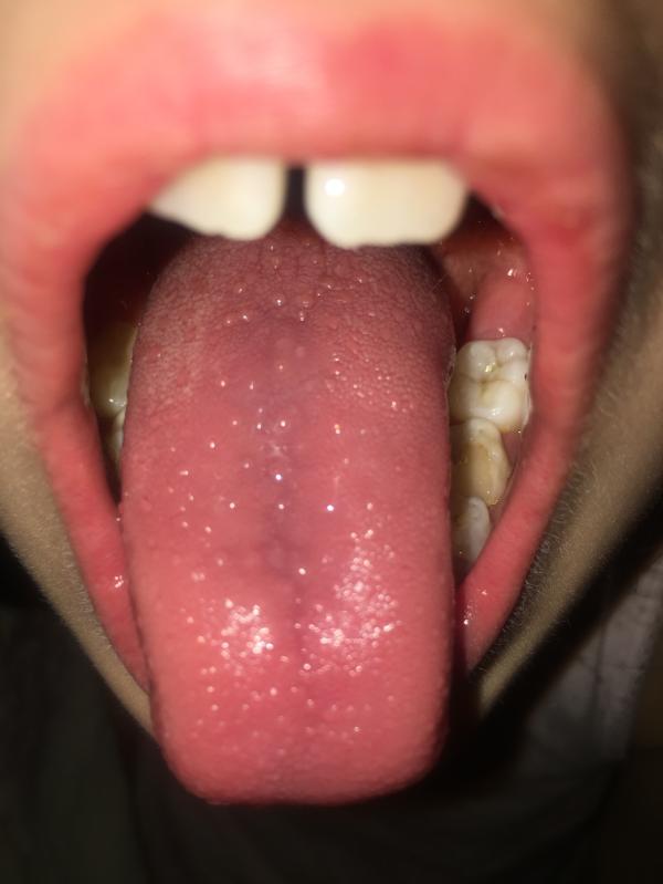 post image 2