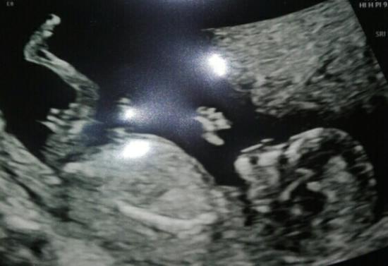 First pregnancy and Im wondering