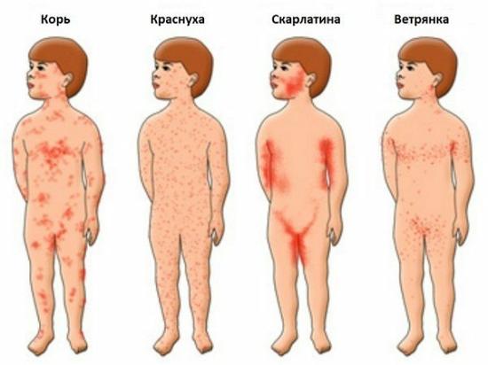 Может кому понадобиться. КРАТКИЙ