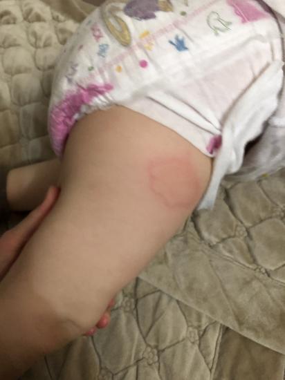 Девочки что это может быть 😳только