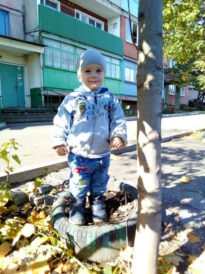 Ох эти зубы. 2 моляра сверху вылезли