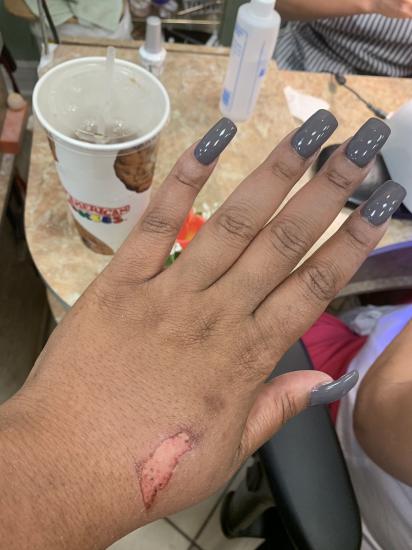 Keeping in theme with my burn 😂