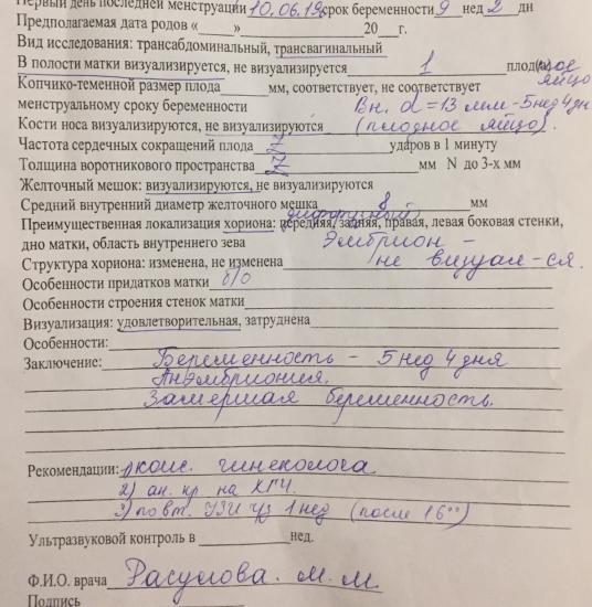 Что и ожидалось)) в любом случае
