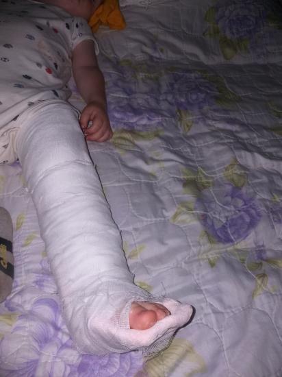 У кого коксаки, у кого то сломанные