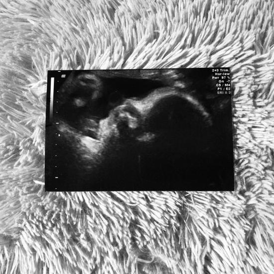 Last peek at our little babe ♥️