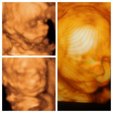 my johnitoo .. cant wait to see