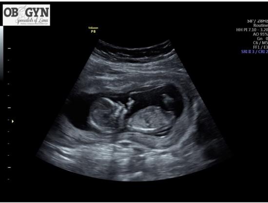 Got to see our last little one