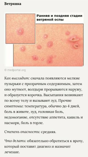 Состояния у детей, сопровождающиеся