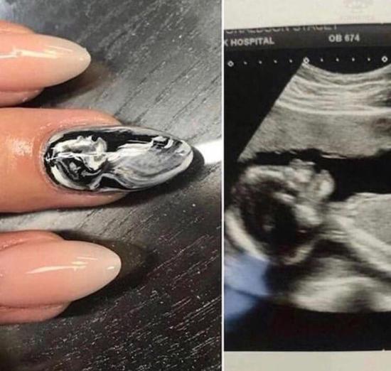 🤦🏼♀️🤦🏼♀️🤦🏼♀️