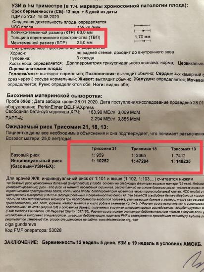 Сегодня была на скрининге первом,