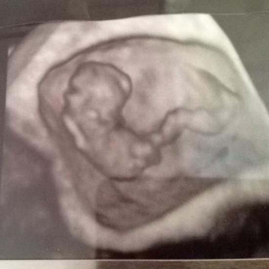 I'm 14 weeks and I'm definitely