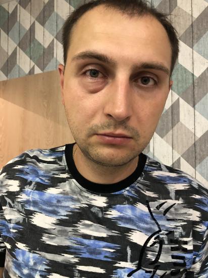 Девочки что это может быть с глазом