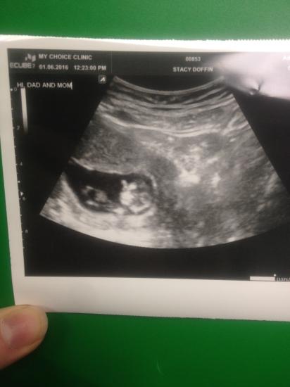 Finally had my first ultrasound