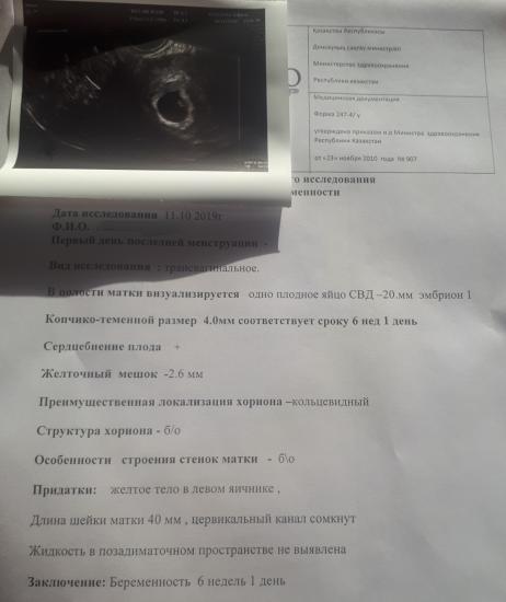 Назначали узи ,проверить сердечко